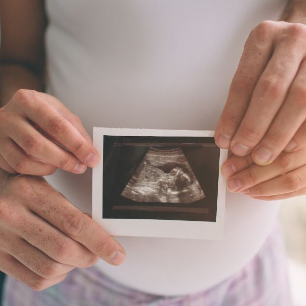 Couple holding a baby ultrasound photo